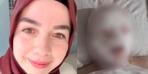 İkinci Vaka Bergen Avcilar'da: Yüzünü yüzüne attı ve gözlerini engelledi! Talihsiz kadın kalbin kalbini yaptı: "Ağlıyorum, kan gözlerimden geliyor"